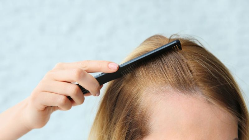 Homéopathie et chute de cheveux : Est-ce une bonne solution ?