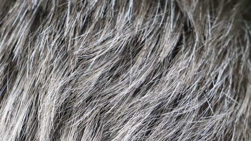 Comprendre la greffe de cheveux 5000 : Explications détaillées et tarifications en Turquie